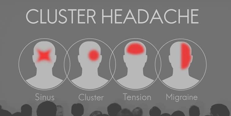 Cluster Headache Causes, Triggers, Symptoms And Treatment