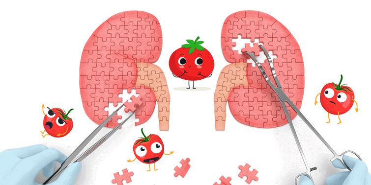 Kidney Stones Caused By Tomatoes Fallacy Or Fact