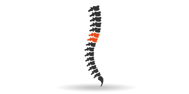 Spinal Cord Injury Causes And Prevention (World Spinal Cord Injury Day)