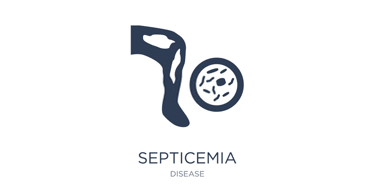 Septicemia Or Sepsis Causes, Symptoms, Treatment And Prevention