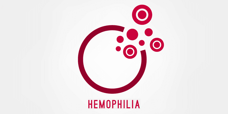 Hemophilia Causes, Symptoms, Diagnosis And Treatment, World Hemophilia Day, blood clotting disorder