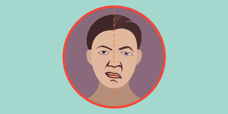 Bell's Palsy Causes, Symptoms, Diagnosis And Treatment, acute peripheral facial palsy